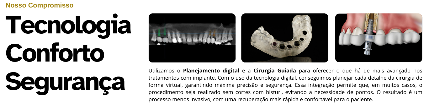 Odontologia digital, Implante dentário digital