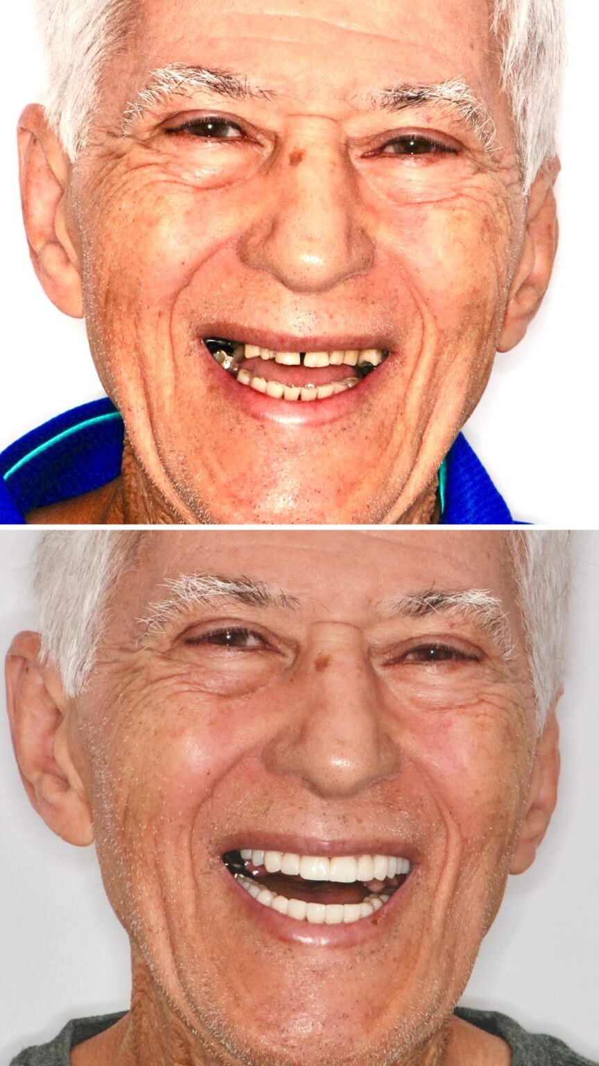 ANTES E DEPOIS DR. WAGNER BRAGA